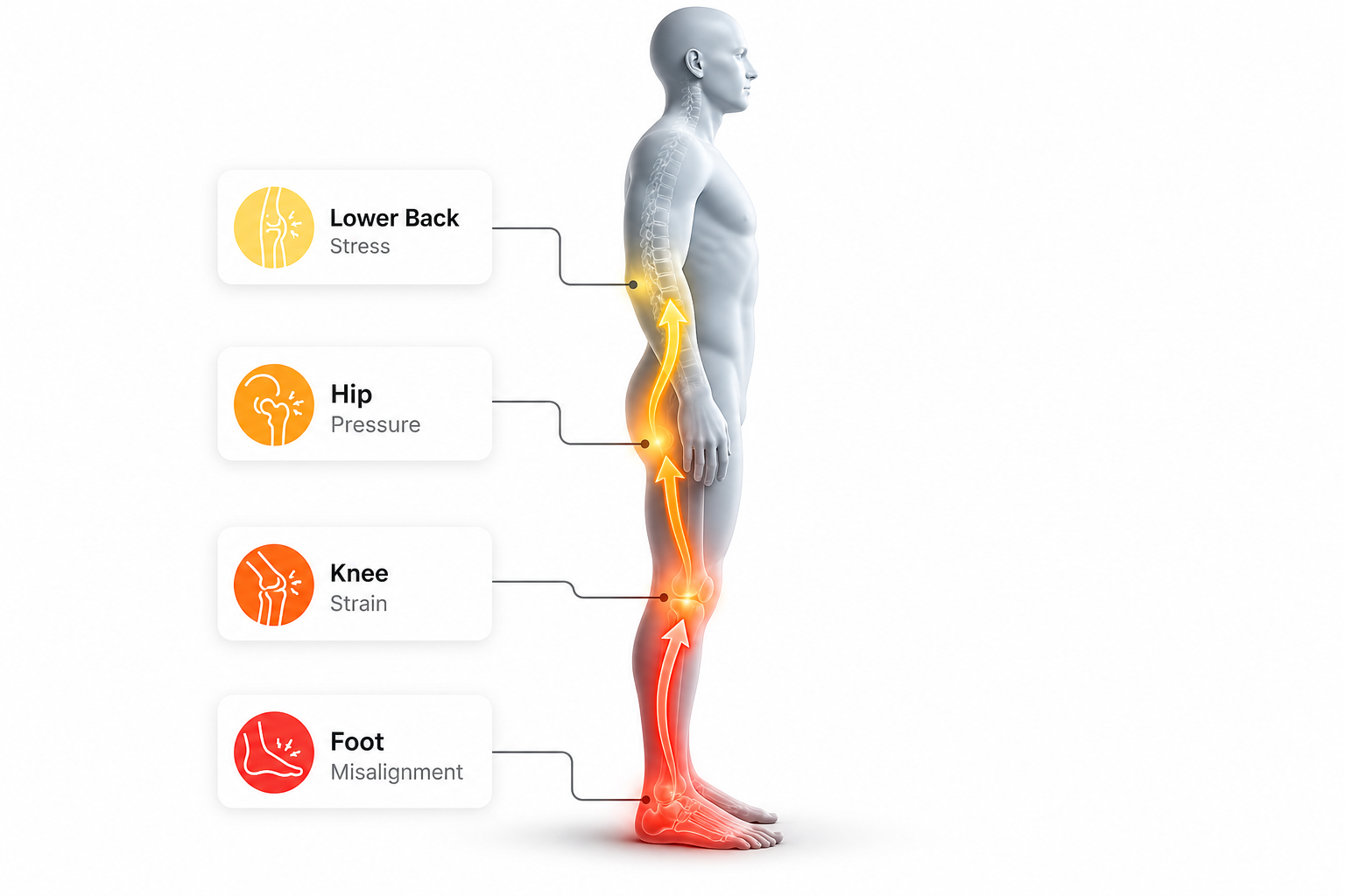 Illustration showing how foot alignment can affect the knees, hips, and lower back