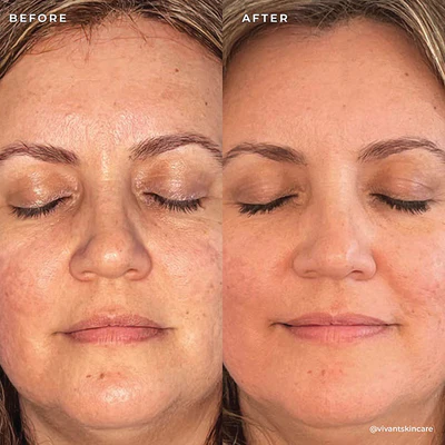 Vivant Mandelic Acid 3-in-1 Exfoliating Cleanser